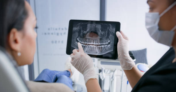 Licensed Wisdom Tooth Removal service in Warren, IL - Smile Center Dentistry